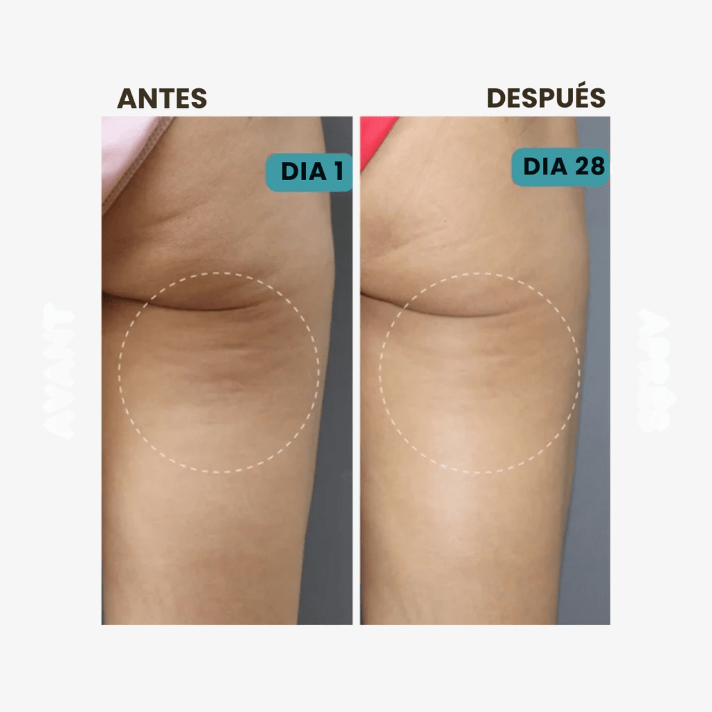 CelluFit™ – Compre 1 y llévese 2 - Calza Anticelulitis Reductoras